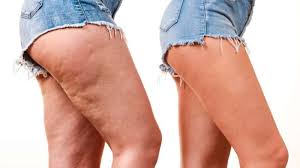 CREMA ANTICELULITIS CON COLAGENO REAFIRMANTE | REDUCE LA PIEL DE NARANJA Y MOLDEA LA SILUETA